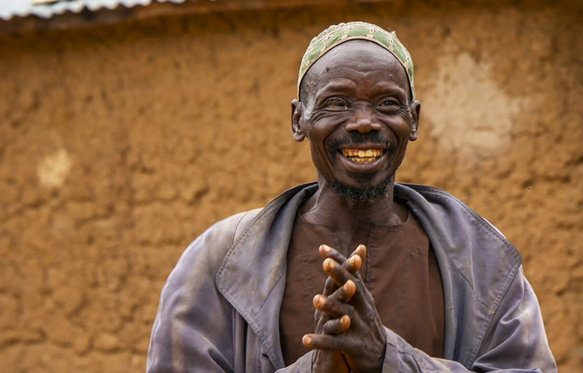 Eye sight Trachoma Adou, a beninese farmer who can care for his animals again