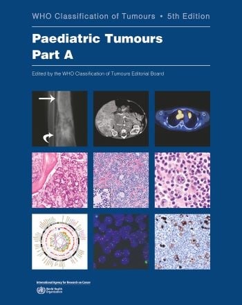 WHO Classification of Paediatric Tumours, 5th edition - Part A WHO Classification of Paediatric Tumours, 5th edition - Part A